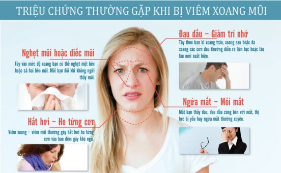 Triệu chứng thường gặp khi bị viêm xoang mũi